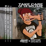 A cover for a tape. Someone who is waiting on hold to centrelink, trying panickedly to peel their face away from their phone screen, which is melted onto the screen in a slapstick fashion. They're wearing a T-Shirt of the artist "Eyes More Skull Than Eyes". The background is a poorly maintained backyard with corrugated iron fencing. The album name, track titles, and artist logos are laid over the top in various fonts, in a style vaguely similar to a hardcore punk poster.
